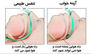 اختلالات خواب در کودکان کیدز 24