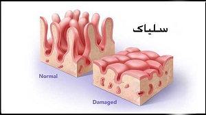 سلیاک کیدز24